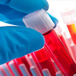 Análises Clínicas e Microbiologia