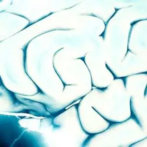 Pós-Graduação em Neurociências EAD com imagem ilustrativa do cérebro