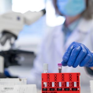 Pós Graduação em Análises Clínicas e Laboratoriais 