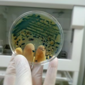 Pós Graduação em Análises Microbiológicas e Parasitológicas